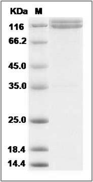 Human N-Cadherin / CD325 / CDH2 Protein (His & Fc Tag) SDS-PAGE