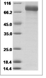 Rat HRG recombinant protein (C-His)