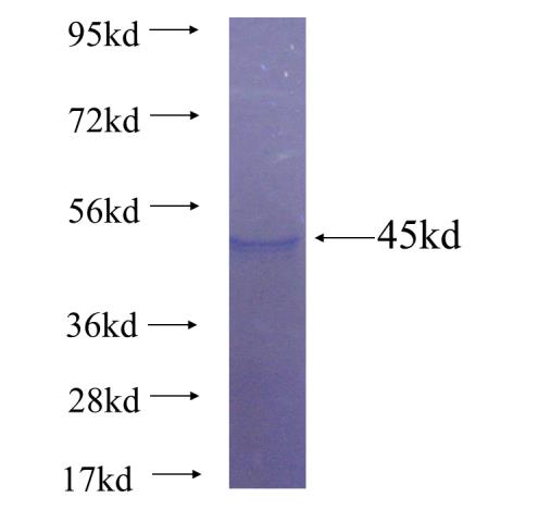 Recombinant human C3orf38(Full length) SDS-PAGE