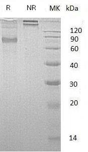 Human IL22RA2/UNQ5793/PRO19598/PRO19822 (Fc tag) recombinant protein
