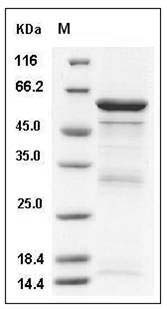 Human TLE3 Protein (aa 484-772, GST Tag) SDS-PAGE