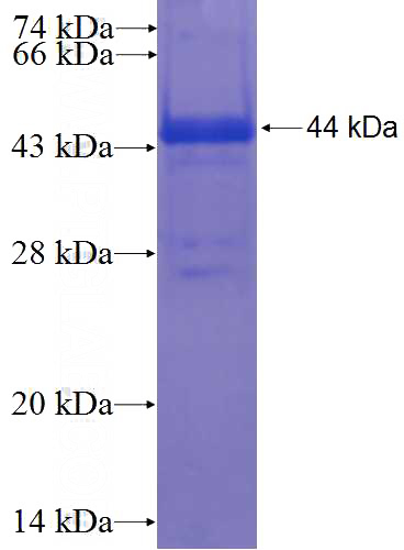 Recombinant Human FBXW10 SDS-PAGE