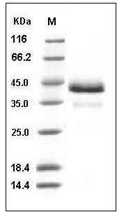 Human Cathepsin B / CTSB Protein (His Tag) SDS-PAGE