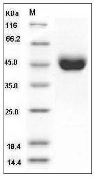 Mouse CD5 / LEU1 Protein (His Tag) SDS-PAGE