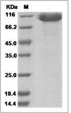 Cynomolgus CD166 / ALCAM Protein (Fc Tag) SDS-PAGE