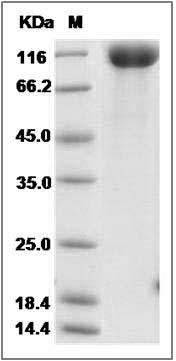 Rat VEGFR1 / FLT-1 Protein (His Tag) SDS-PAGE