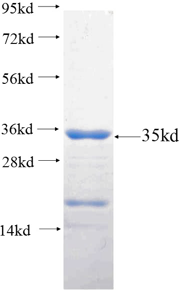 Recombinant Human ADAD1 SDS-PAGE