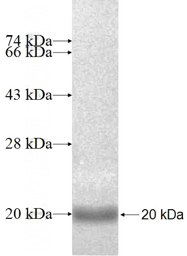 Recombinant Human GS28 SDS-PAGE
