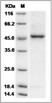 Human B3GNT6 Protein (aa 44-384, His Tag) SDS-PAGE