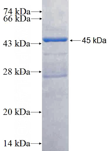 Recombinant Human ADAL SDS-PAGE