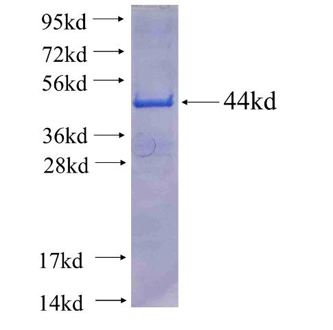 Recombinant human EPRS SDS-PAGE