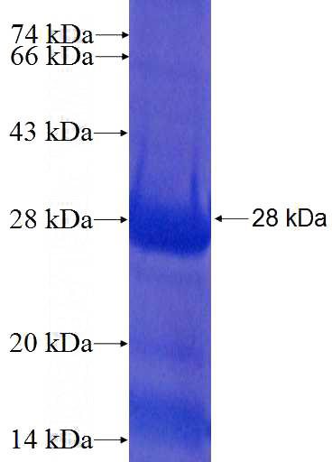 Recombinant Human RPL19 SDS-PAGE