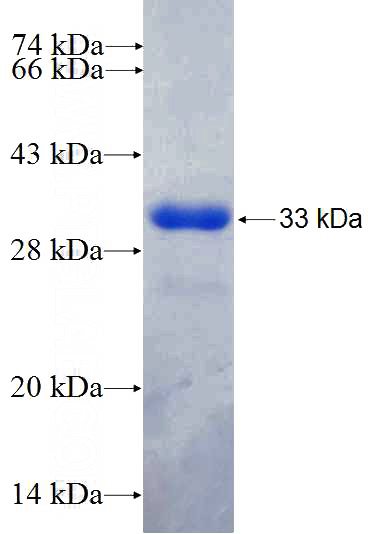 Recombinant Human PPP1R12C SDS-PAGE