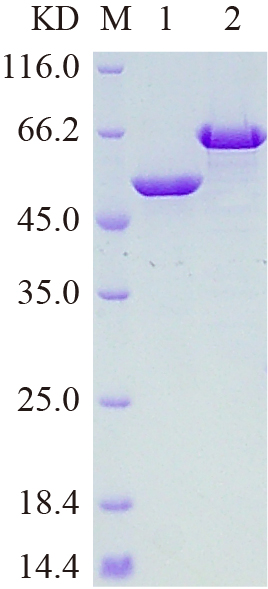 Recombinant FKRP protein (His tag) SDS-PAGE
