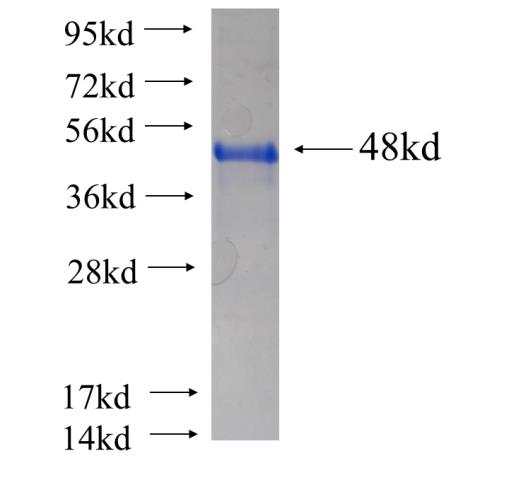 Recombinant human OBFC2B(Full length) SDS-PAGE
