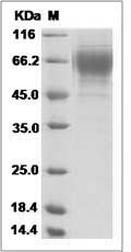 Influenza A H3N2 (A/Missouri/09/2014) Hemagglutinin / HA1 Protein (His Tag)