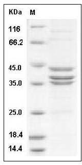 Human CDK7 & CCNH & MNAT1 Heterotrimer Protein SDS-PAGE