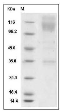 Mouse SIRP alpha / CD172a Protein (Fc Tag) SDS-PAGE