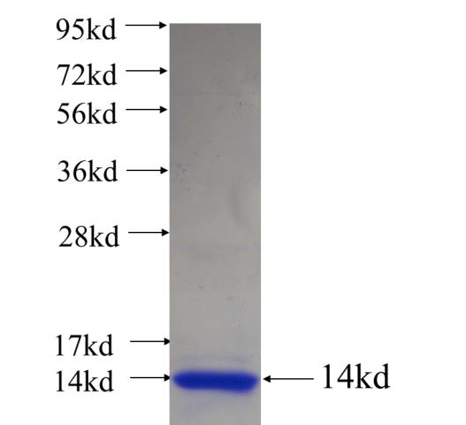 Recombinant human C11orf83 SDS-PAGE