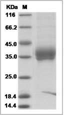 Il4r protein SDS-PAGE