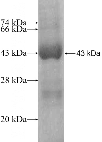 Recombinant Human DNAJC24 SDS-PAGE