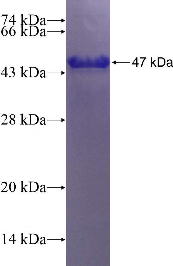 Recombinant Human DST SDS-PAGE