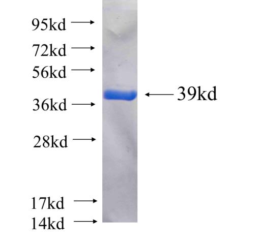 Recombinant human ACTN4 SDS-PAGE