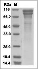 Mouse CDH13 / Cadherin-13 / H Cadherin Protein (His Tag) SDS-PAGE