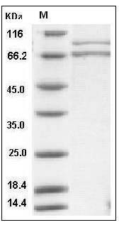 Human XRCC5 & XRCC6 Heterodimer Protein SDS-PAGE