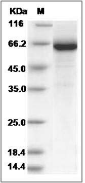 Rat GP1BB / CD42c Protein (Fc Tag) SDS-PAGE