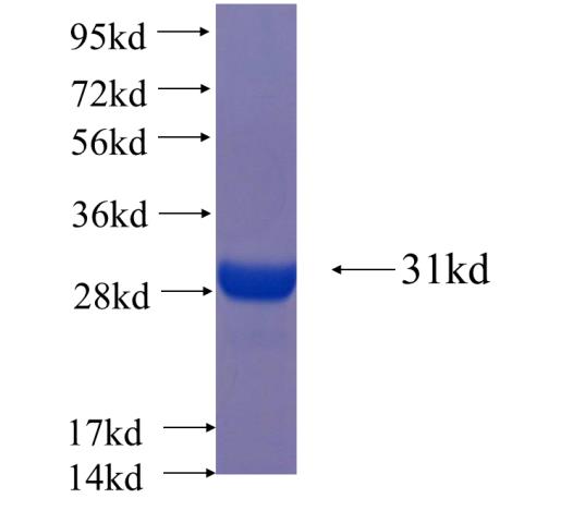 Recombinant human BFSP2 SDS-PAGE