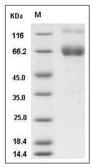Mouse IFNGR1 / CD119 Protein (Fc Tag) SDS-PAGE