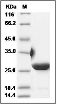 Human EMC8 / COX4NB / NOC4 Protein (His Tag) SDS-PAGE