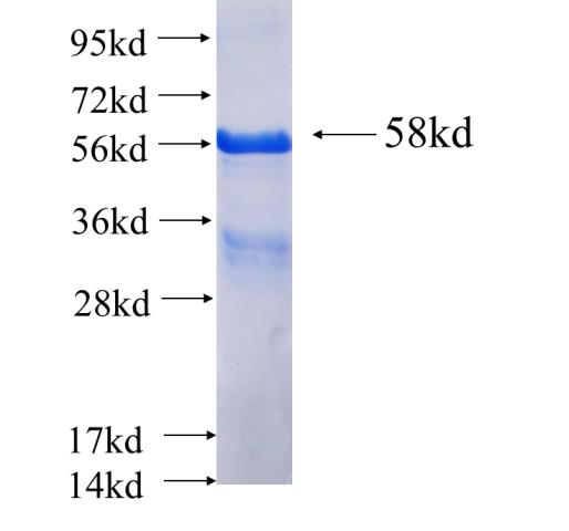 Recombinant human ARMCX2 SDS-PAGE