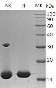 Human FABP1/FABPL (His tag) recombinant protein