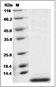 Human SMR3B Protein (His Tag) SDS-PAGE