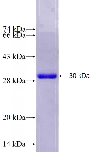 Recombinant Human SGPL1 SDS-PAGE