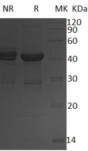 Human UBE2D4/UBCH5D (GST tag) recombinant protein
