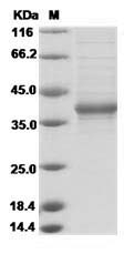 Human FAM150A Protein (Fc Tag)