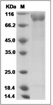 Mouse IL1RL1 / ST2 Protein (Fc Tag) SDS-PAGE