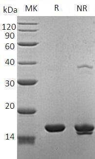 Human FABP7/BLBP/FABPB/MRG (His tag) recombinant protein