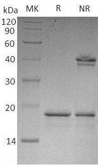Human PFDN2/PFD2/HSPC231 (His tag) recombinant protein