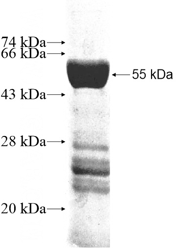 Recombinant Human PDCL2 SDS-PAGE