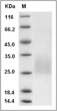 Rat REG4 Protein (His Tag) SDS-PAGE