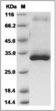 Human LMAN2L Protein (His Tag) SDS-PAGE