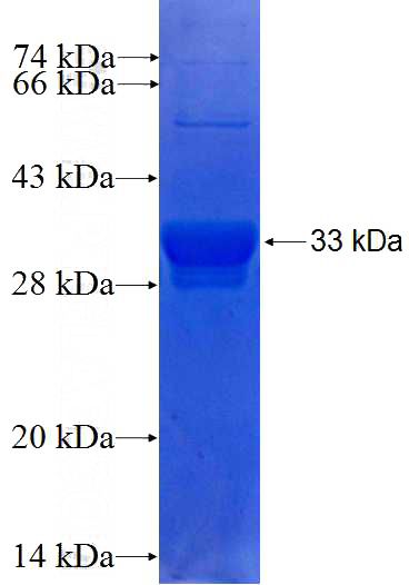 Human SLC25A12 Recombinant protein (GST tag)