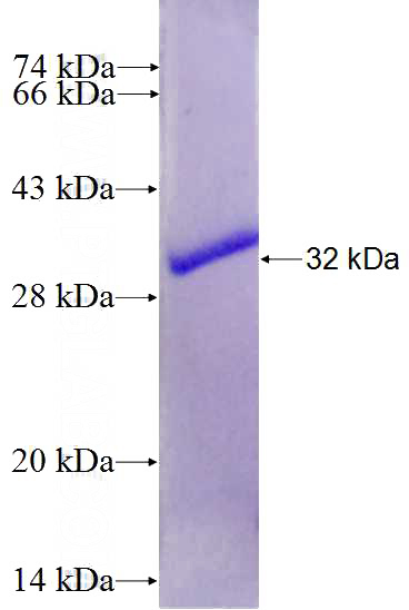 Recombinant Human PLD5 SDS-PAGE