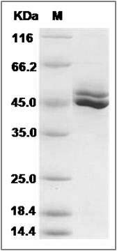 Rat IL12B / IL-12B Protein (His Tag) SDS-PAGE