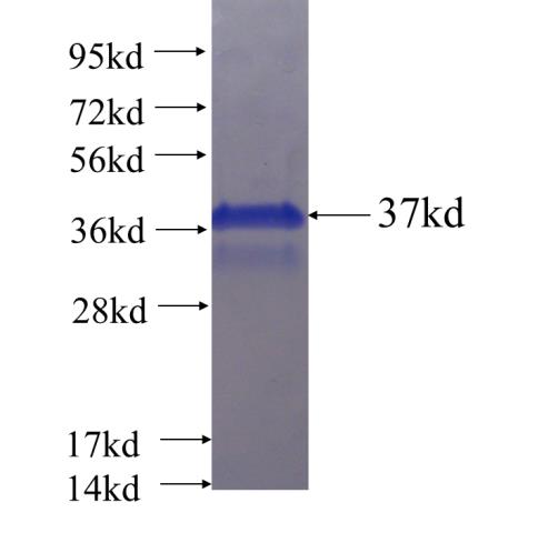 Recombinant human G0S2 SDS-PAGE