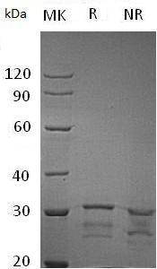 Human IDI2 (His tag) recombinant protein